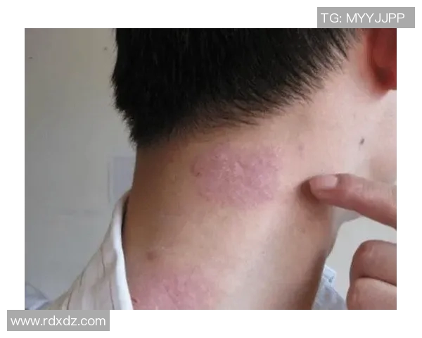 帕金森病症状冬季加重：手部抖动加剧、肌肉僵硬如何应对？寒冷血液循环影响与保暖方法全解析